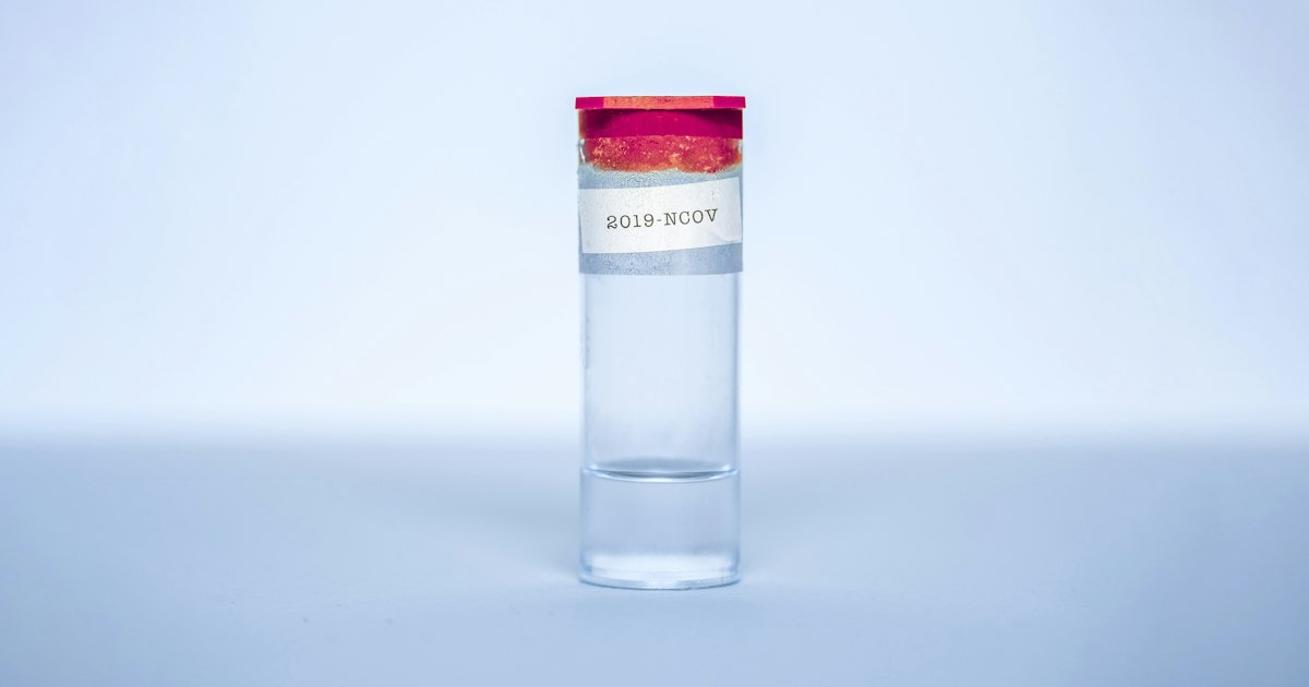Hoe je je voorbereidt op de test «Prolactine»: regels voor de afname